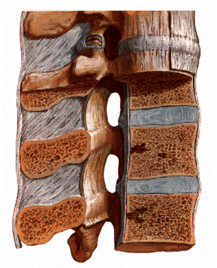 Процедура пункційної вертебропластики