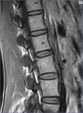 Анатомія хребця